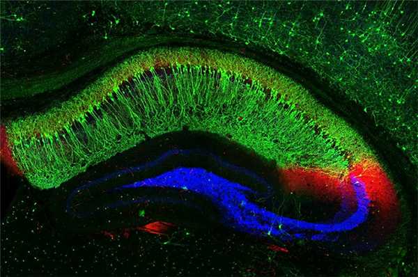 работа нейронов гиппокампа