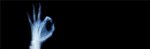 здоровые кости