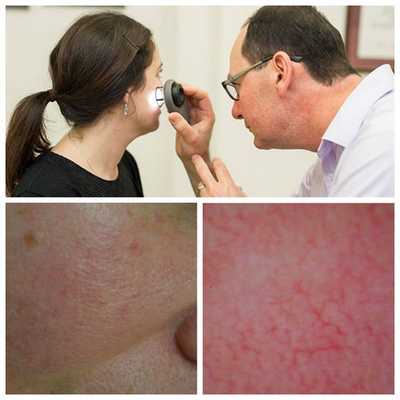 Дерматоскопия