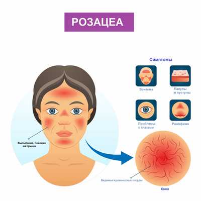 Тюлис Галина Геннадьевна, дерматолог - Уфа