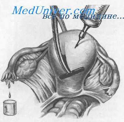 Проверка проходимости труб во время операции