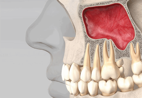 Строение верхней челюсти, носовая полость и гайморовые пазухи