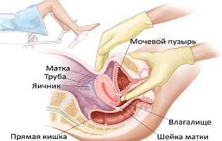 Как проводится влагалищное исследование