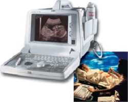 УЗИ аппарат
