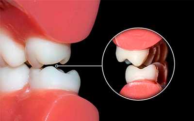 Если не лечить - Линия Улыбки