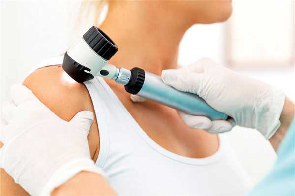 Врач проводит дерматоскопию