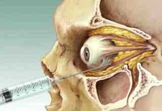 Анестезия при операциях на глазах