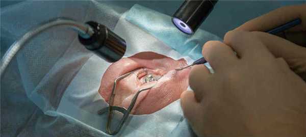 Обезболивание в офтальмологии