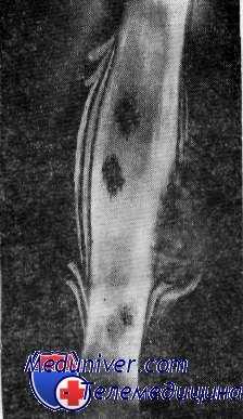 кость на рентгенограмме