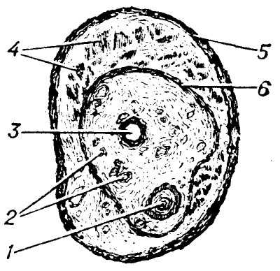 Рис. 2. Схематическое изображение строения семенного канатика на поперечном разрезе в его средней части: 1 — семявыносящий проток; 2 — лозовидное венозное сплетение; 3 — яичковая артерия; 4 — мышца, поднимающая яичко; 5—фасция мышцы, поднимающей яичко; 6— внутренняя семенная фасция.