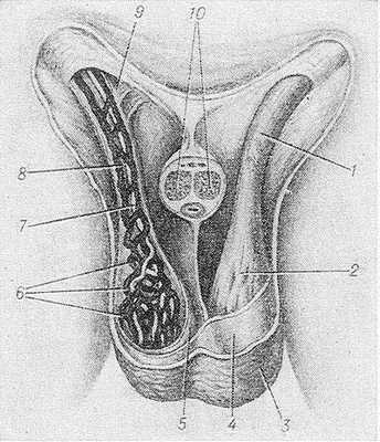 Рис. 1. Схематическое изображение строения и топографии дистального отдела семенного канатика (передняя стенка мошонки и половой член удалены, справа отпрепарированы элементы семенного канатика): 1 — семенной канатик (дистальный отдел); 2 — мышца,поднимающая яичко, и ее фасция; 3 — кожа мошонки; 4 — мясистая оболочка; 5 — наружная семенная фасция; 6 — лозовидное венозное сплетение; 7 — яичковая артерия; 8 — семявыносящий проток; 9 — поверхностное паховое кольцо; 10 — пещеристые тела полового члена (разрез).