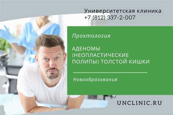 You are currently viewing Аденомы (неопластические полипы) толстой кишки