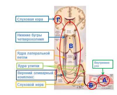 Рисунок 4. Поражение звуковоспринимающего аппарата возникает при поражении внутреннего уха (А), слухового нерва (Б), подкорковых структур слухового анализатора (В) и слуховой коры (Г).