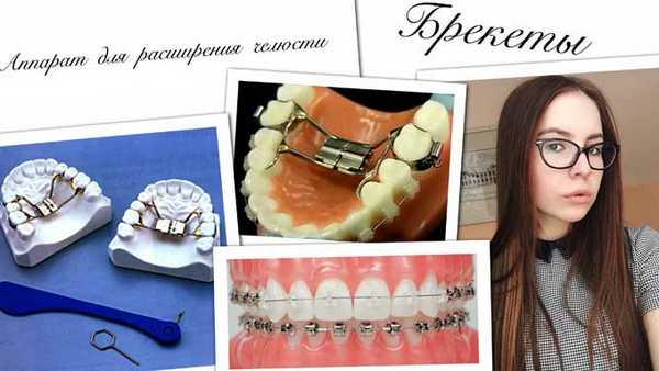 аппарат дерихсвайлера