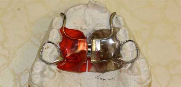 аппарат дерихсвайлера изготовление