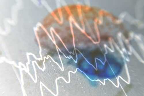 Очаги эпилепсии в коре головного мозга