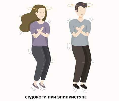 Судороги подростков при эпилепсии