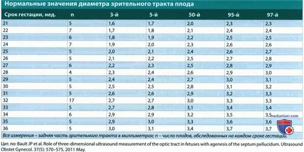 УЗИ, МРТ при септооптической дисплазии (СОД) у плода