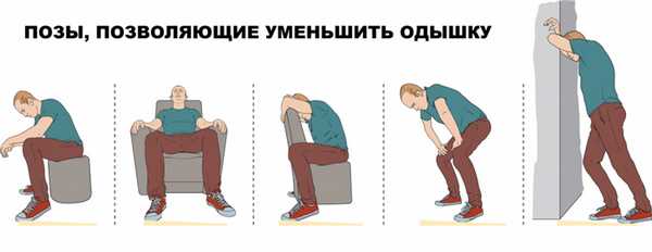 Сердечная астма