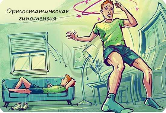 Ортостатическая гипотензия