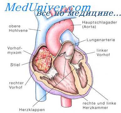 артериальная термодилюция