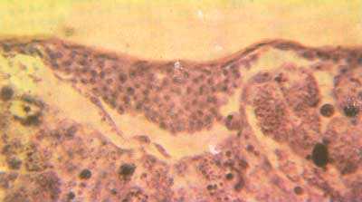 Рис.1б. Развитие первичной сети сосудов. Срез.