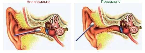 Использование ватных палочек