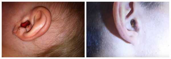 Серные пробки