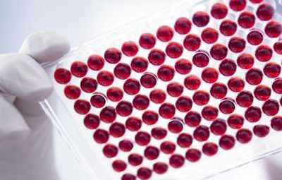 Количество крови забираемое на серологическую реакцию