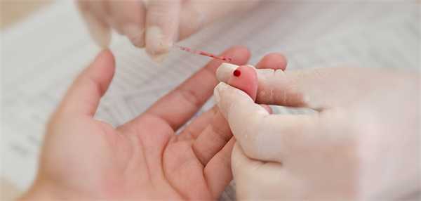 анализ крови – капля крови