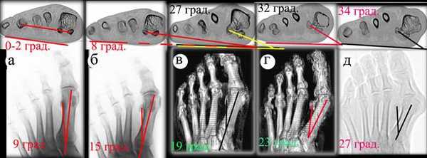 к патенту5а
