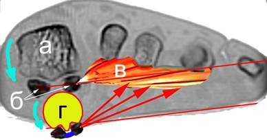 плоскостоп ротация механизм.jpg