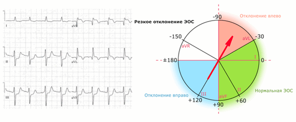 ЭОС отклонение влево: минус 60 градусов.