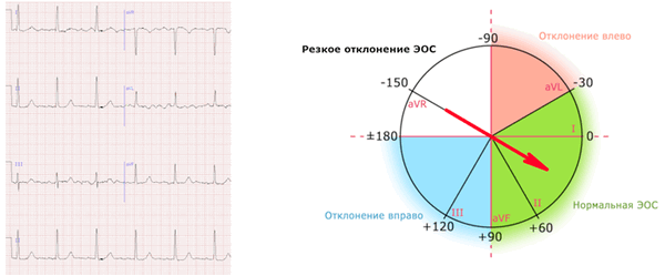 Нормальное положение ЭОС +30
