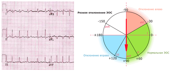 ЭОС вертикальное положение.