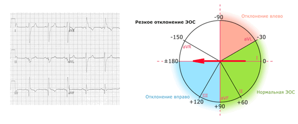 ЭОС резкое отклонение 180 градусов.