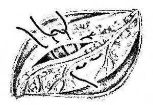 Использование П-образных швов с проведением нити под крупными неповрежденными ветками коронарных артерий поможет избежать некроза стенки миокарда