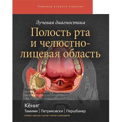 Лучевая диагностика. Полость рта и челюстно-лицевая область - Кениг Лиза Дж.