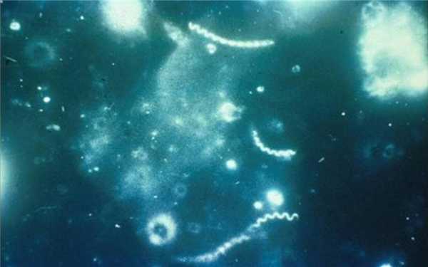 Спирохета сифилиса