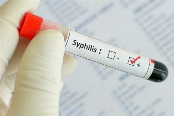 Диагностика сифилиса