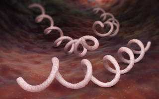 Бледная трепонема