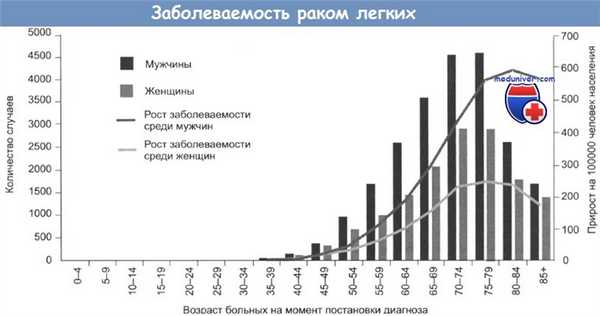 Заболеваемость раком легких