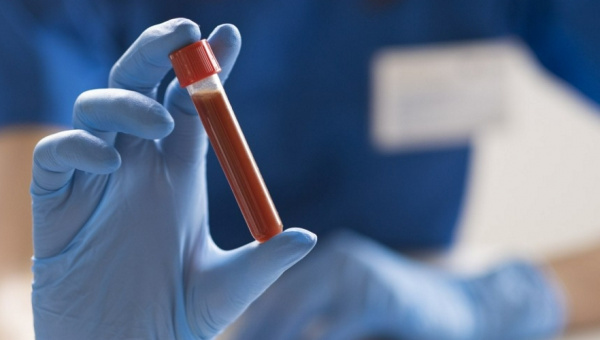 Панцитопения