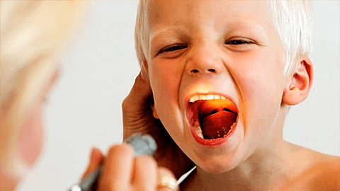 Симптомы и признаки воспаления аденоидов