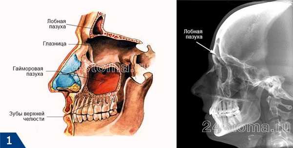 Лобная пазуха вид на схеме и на рентгеновском снимке черепа (вид сбоку)