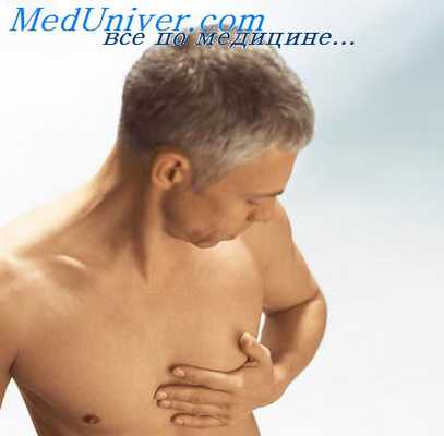 инфаркт миокарда