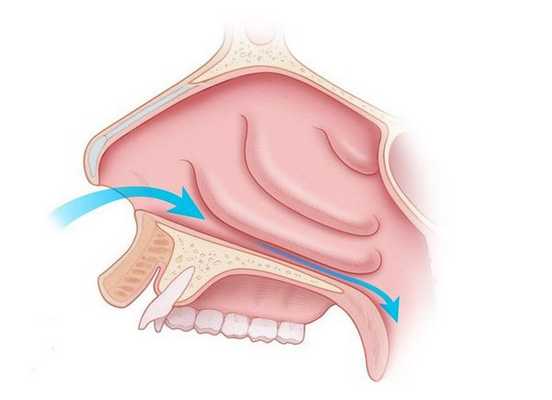 Расширение носового хода после коагуляции
