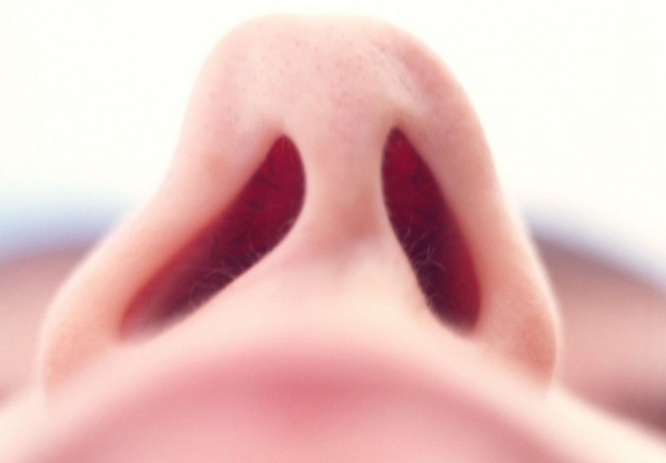 Искривление носовой перегородки