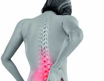 Фото Симптомы ишиаса