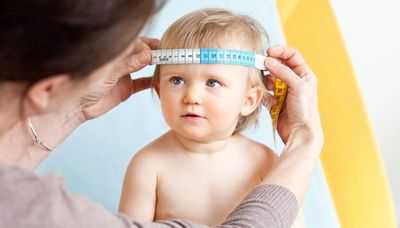 Аномалия Киари